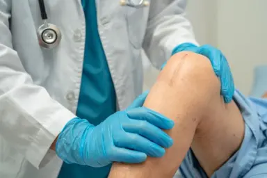 Doctor examining a healed knee replacement scar during a follow-up appointment in Siliguri