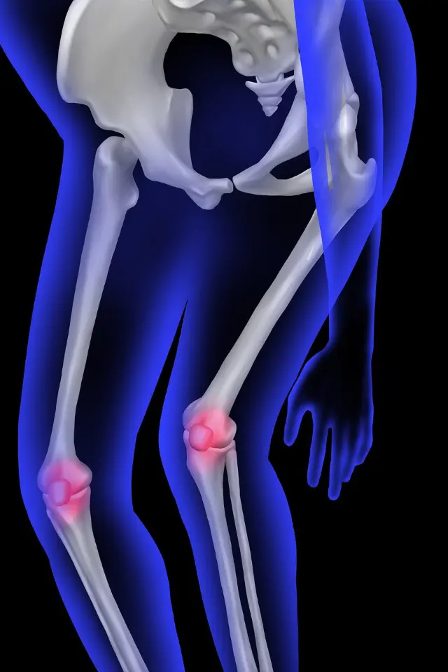 3D medical illustration of human legs showing the skeleton with red highlighted knee joints indicating pain or inflammation