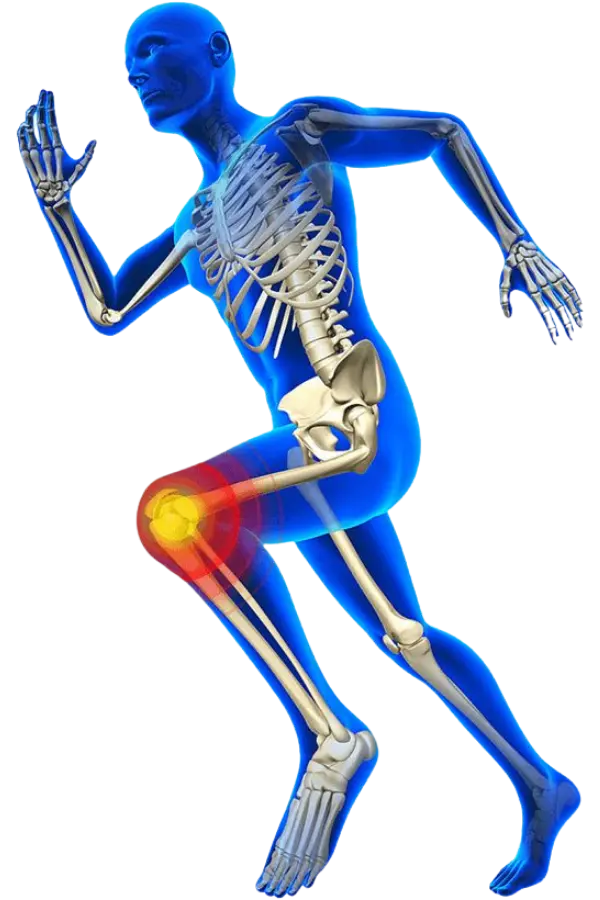 3D illustration of a running human figure with a red glowing knee joint indicating runner's knee or injury